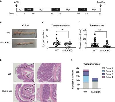 Integrin-linked kinase expression in myeloid cells promotes colon tumorigenesis